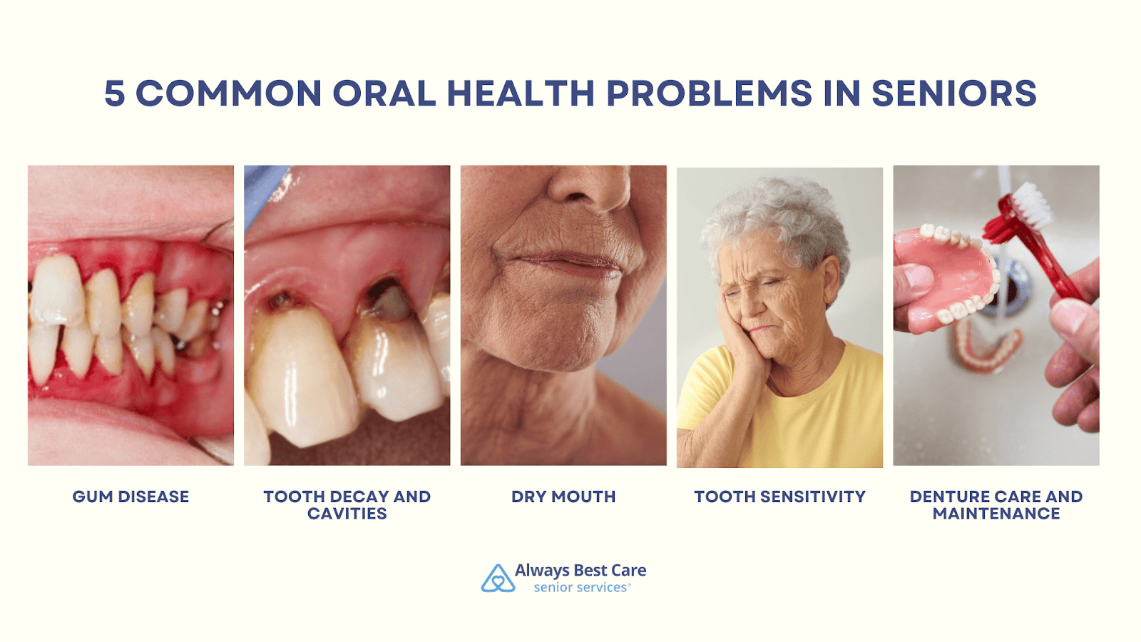 This is an infographic detailing the 5 common oral health problems in seniors