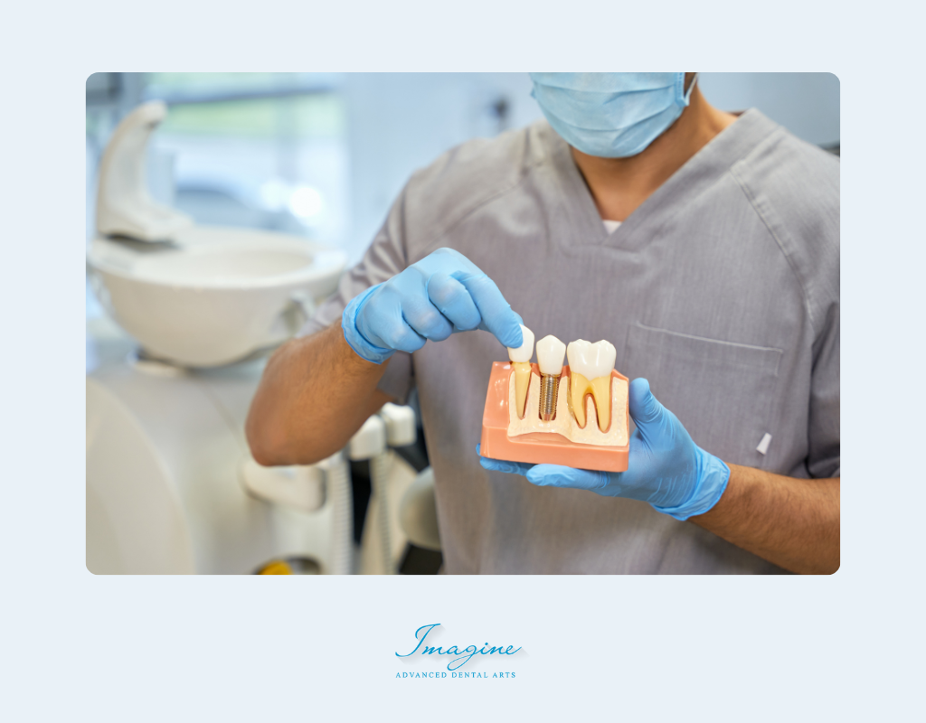 What Are Dental Implants and All On X?