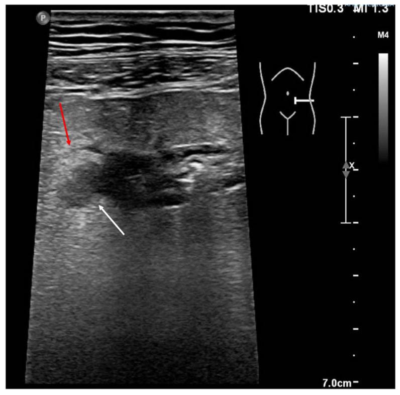 Figure 9