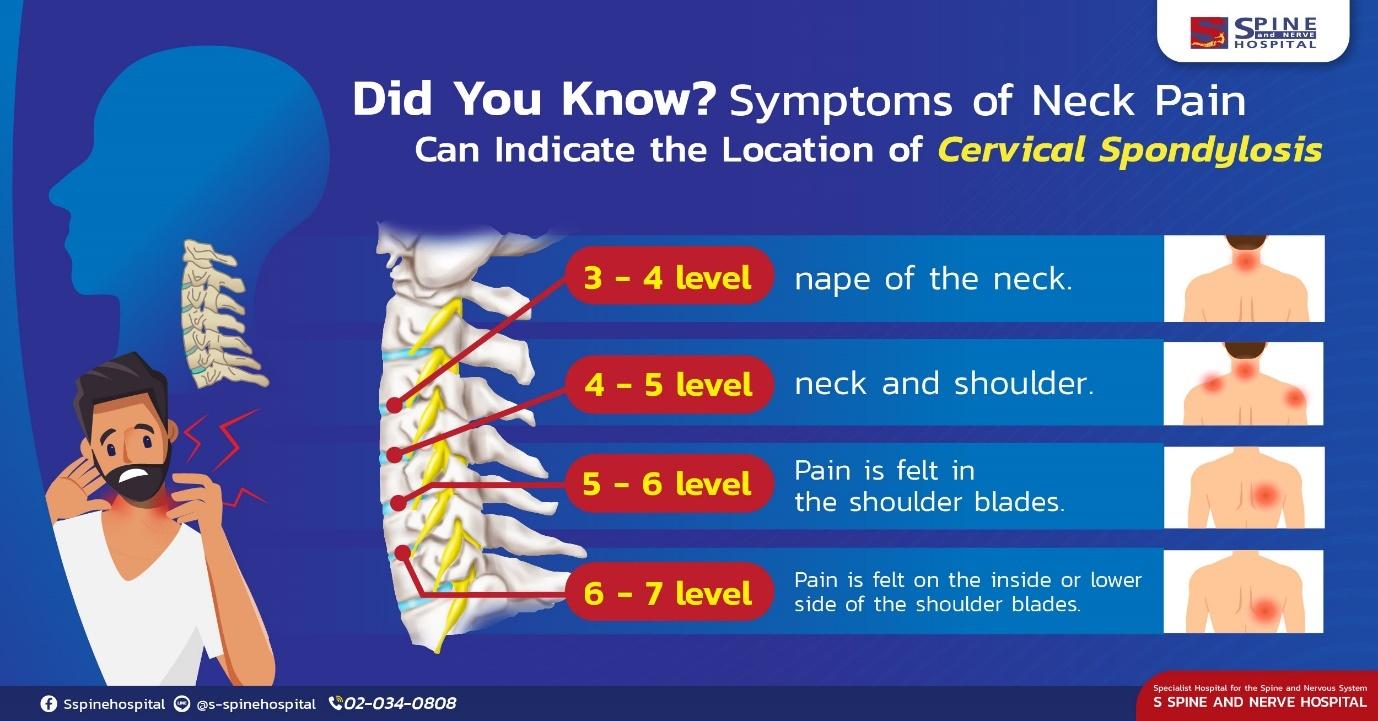 A diagram of the spine

Description automatically generated