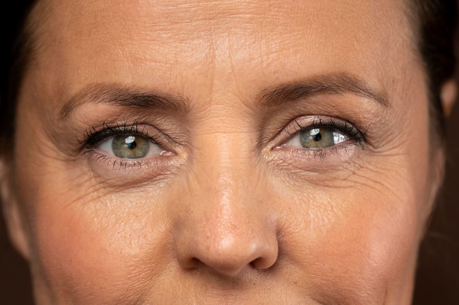botox results
