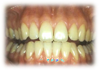 C:\Documents and Settings\Administrateur\Mes documents\Mes images\img193.jpg