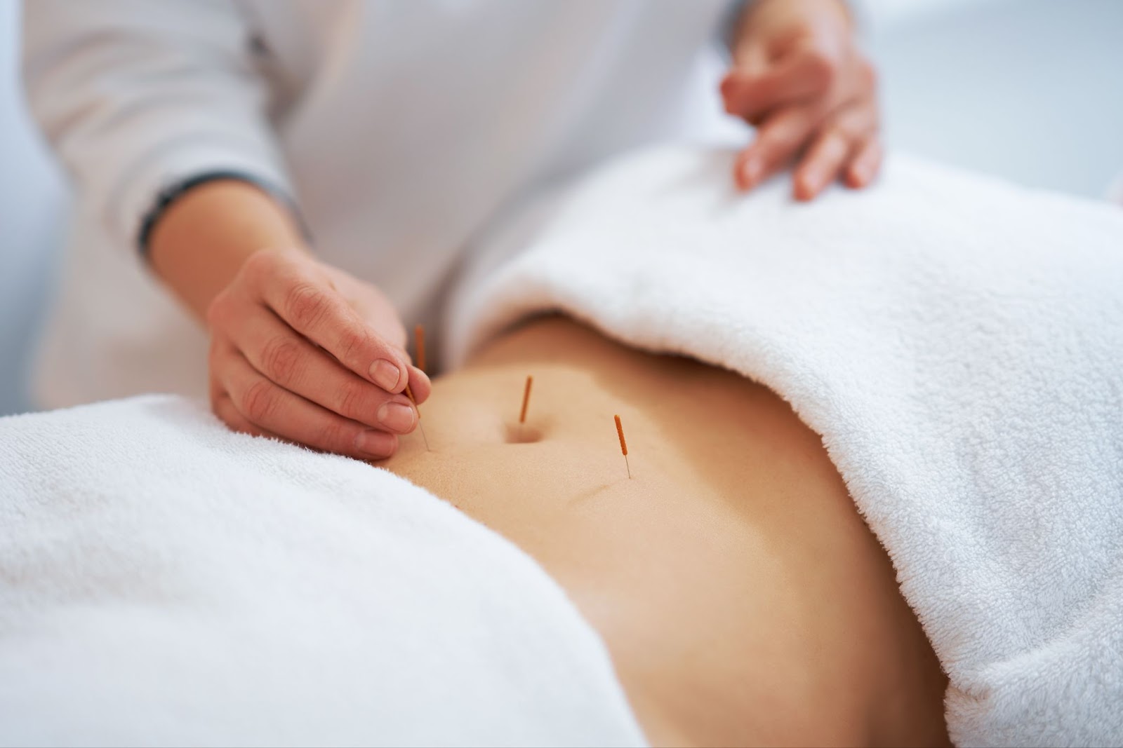 Person with acupuncture needles in their stomach. 