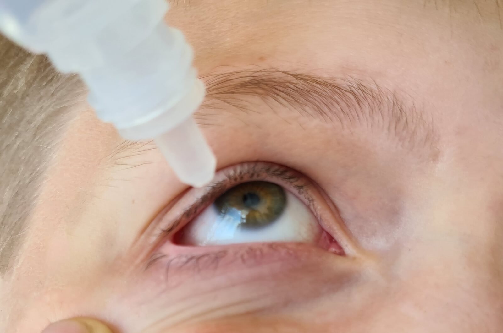 A close up view of eye drops being applied to a child's eye.