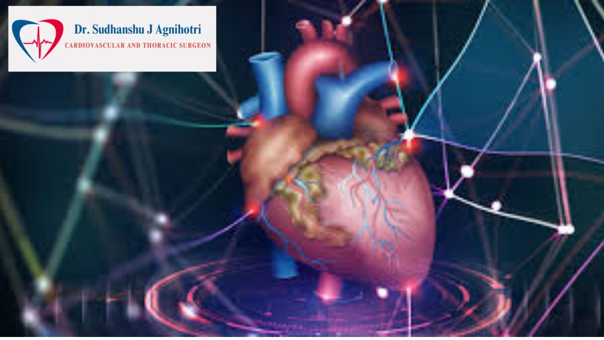 Heart Transplant - dr Sudhanshu J Agnihotri, a top 10 cardiologist in indore