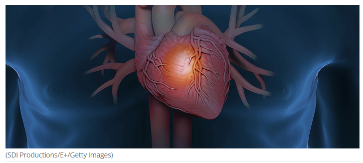 A heart with veins and arteries

Description automatically generated with medium confidence