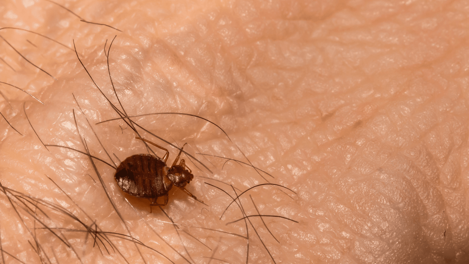 Close-up of a bed bug on skin, showing why Texas bed bug experts recommend professional treatment for these reddish-brown pests