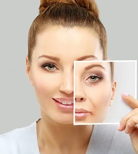 in this image the difference is given before and after anti aging treatment by https://ageology.in/ 