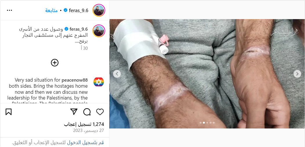 A screenshot of a released detainee’s wrist (Instagram)
