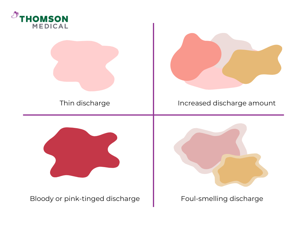 Different cervical cancer discharges 