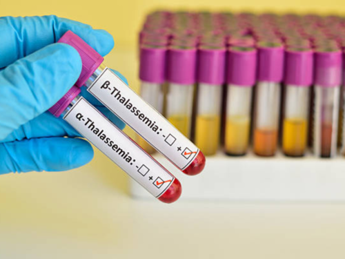 Thalassemia: Here's all you need to know about the blood disorder​ | The  Times of India