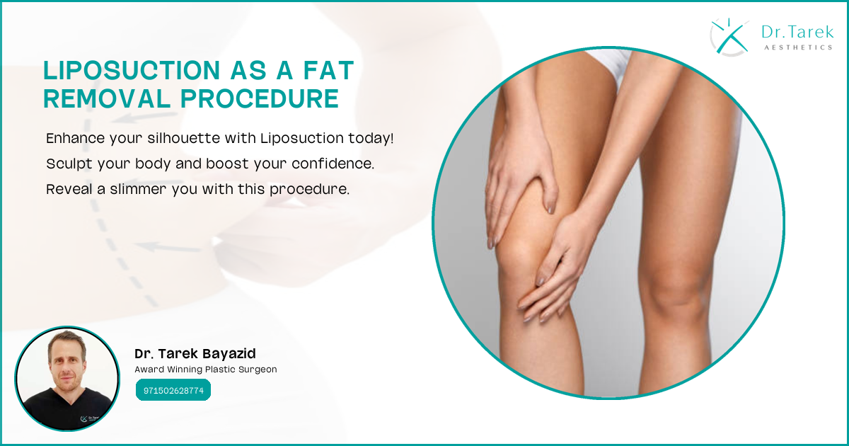 Can Liposuction Help With Weight Loss