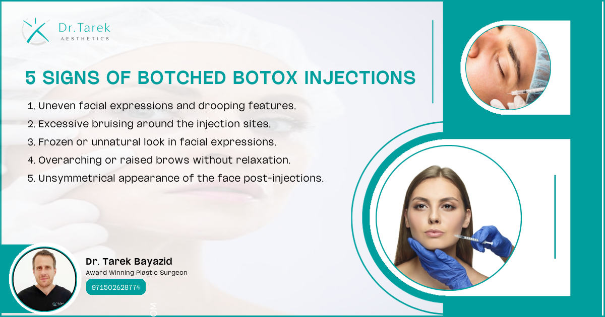 What Happens When Botox Goes Wrong?