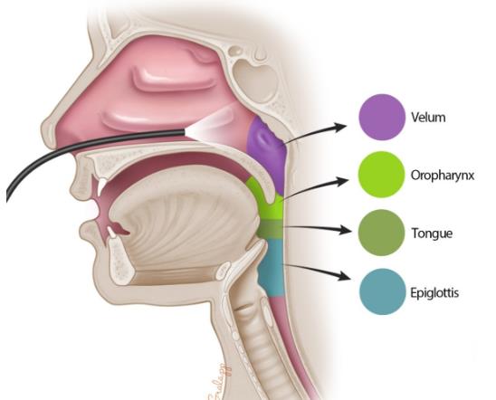 dise Procedure