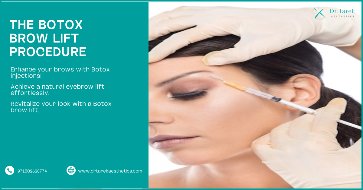 Can Botox Enhance Eyebrows?