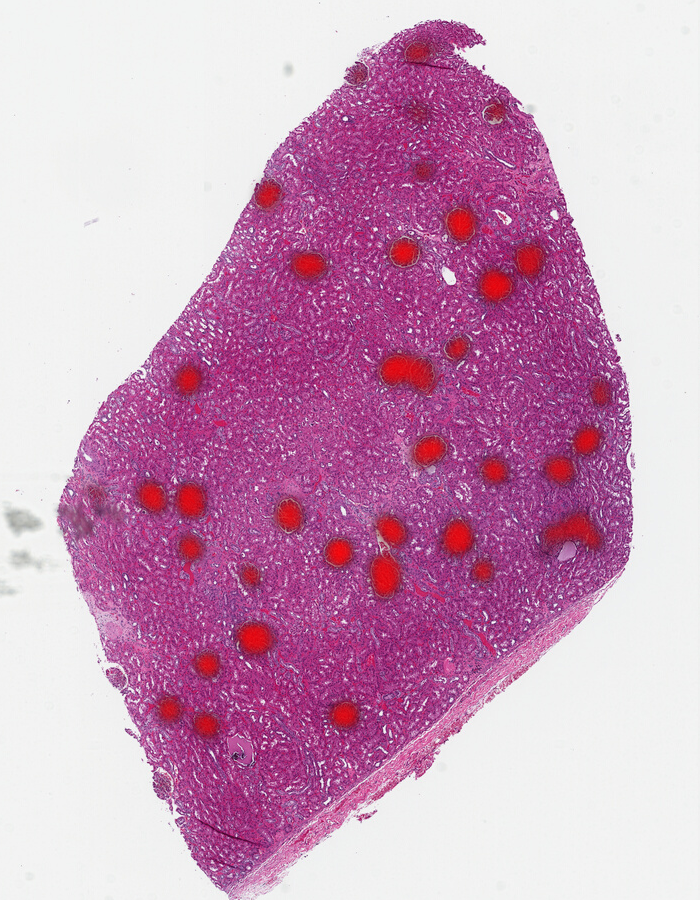 The sample renal tissue with most of the glomeruli located using the DinoV2 foundation model