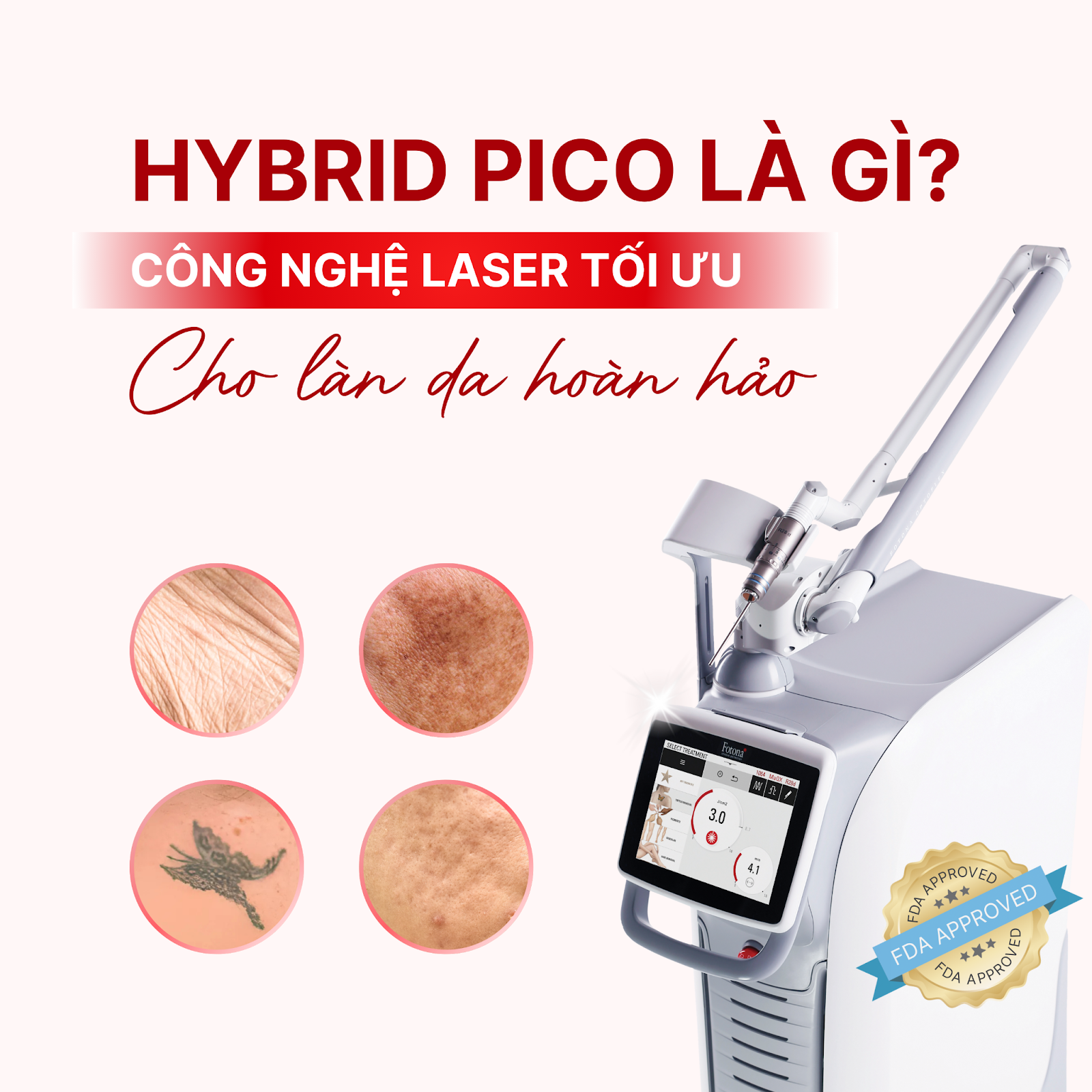 HYBRID PICO LÀ GÌ? CÔNG NGHỆ LASER TỐI ƯU CHO LÀN DA HOÀN HẢO