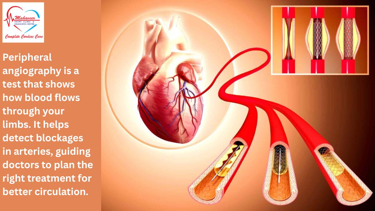 Peripheral Angiography by Dr rakesh Jain a Best Cardiologist