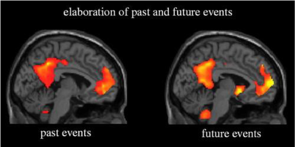 A close-up of a brain

AI-generated content may be incorrect.