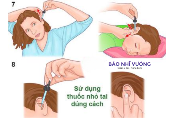 hướng dẫn sử dụng nhỏ tai