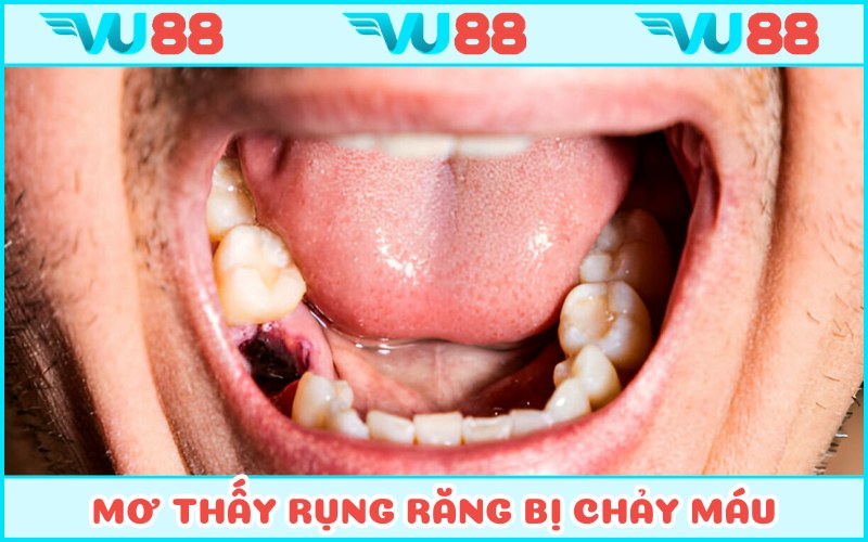Mộng mị bị chảy máu khi gãy