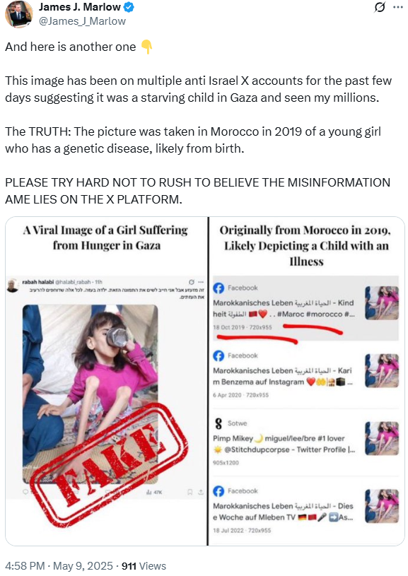Israeli Trolls Claim Gazans Lied About Malnourished Girl