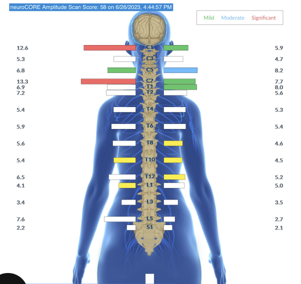 How to Fix Adrenal Fatigue Naturally | PX Docs