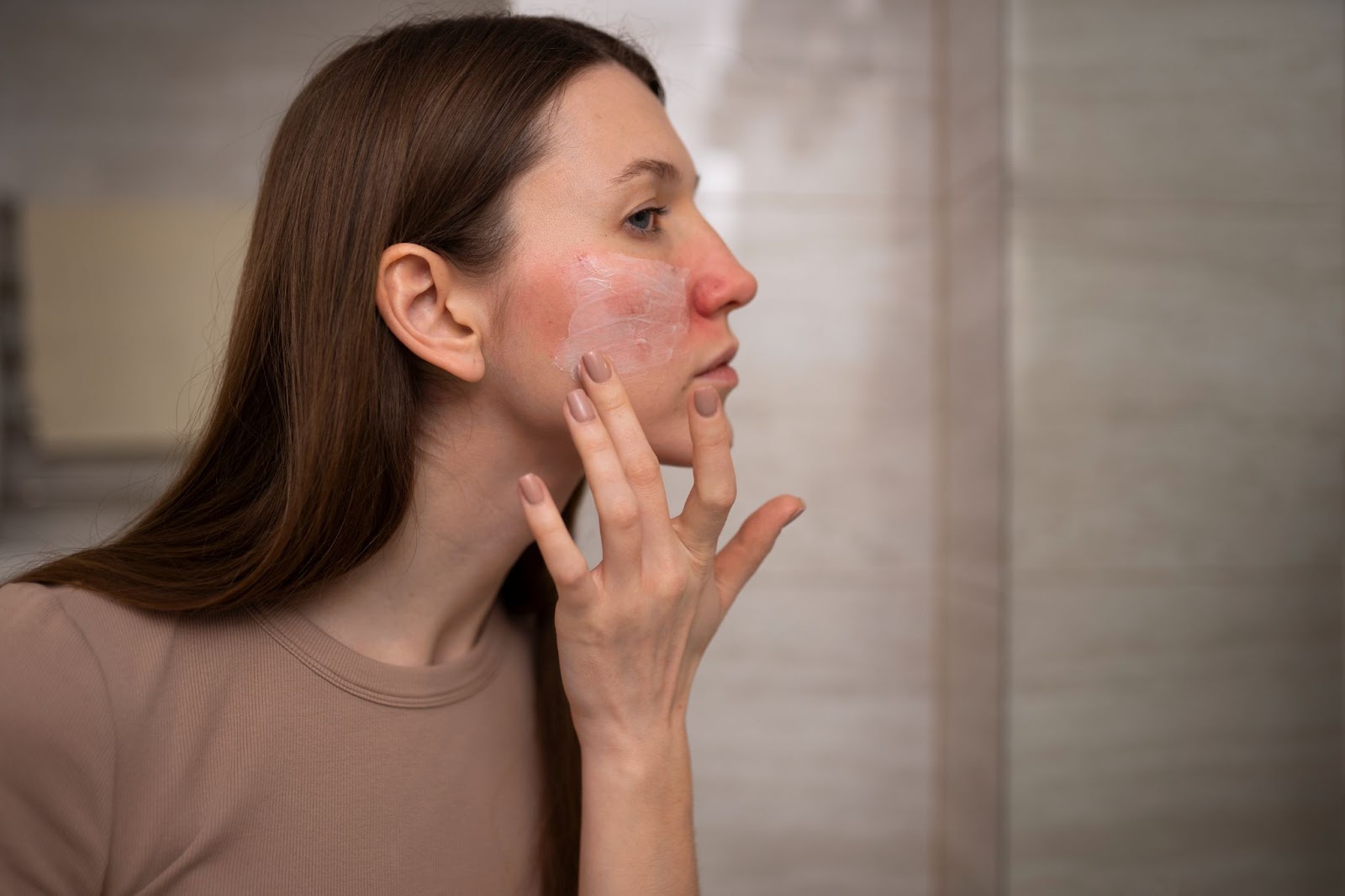 Woman with rosacea applying moisturizer to her cheek.