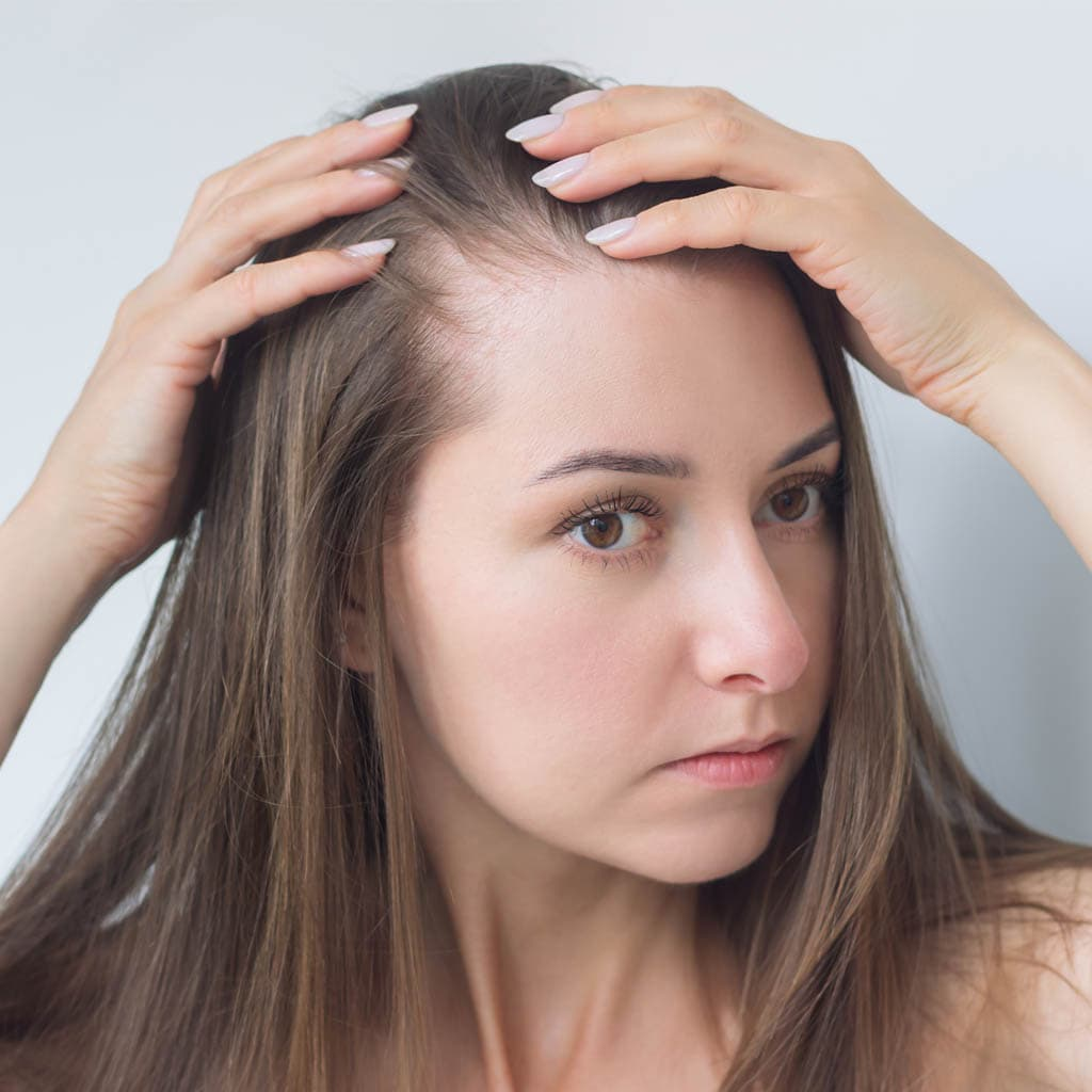 in this image the girl is facing the hair line thinning issues can be correct with hair patch. by https://renewyou.co.in/hair-patch-hair-wigs/