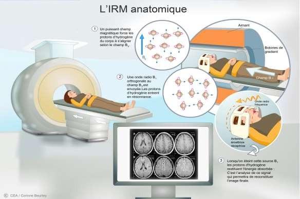 Le traitement de l'image
