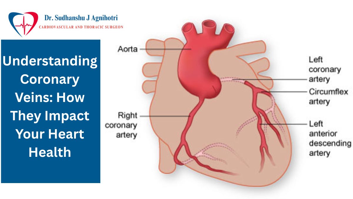 Coronary Veins - Dr Sudhanshu J Agnihotri a  Cardiologist in Indore