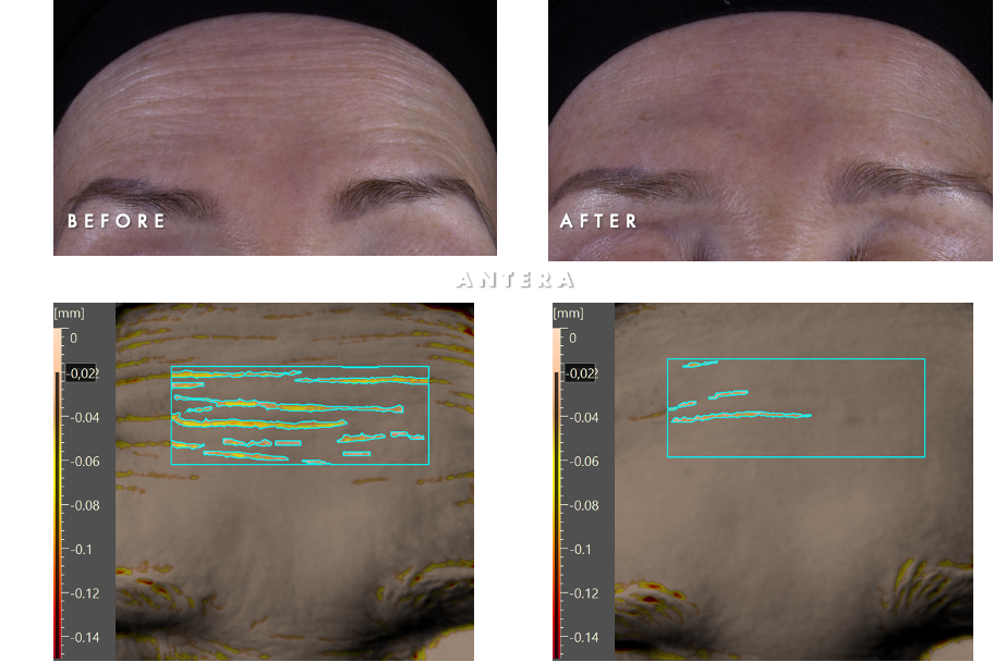 A close up of a person&#39;s forehead

AI-generated content may be incorrect.