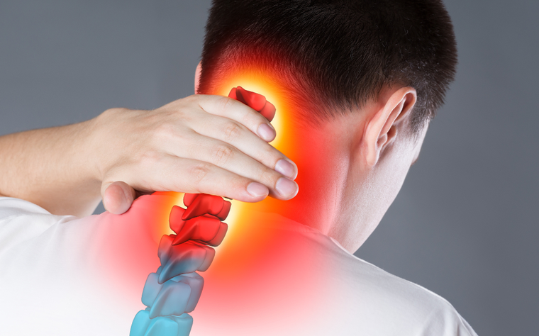 O que é Hérnia de Disco Cervical? Saiba como tratá-la! - Blog Fisioterapia