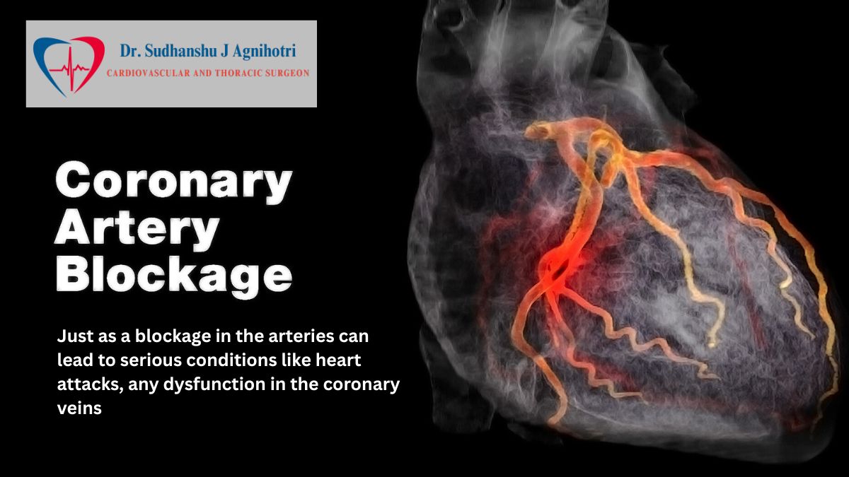 Dr Sudhanshu J Agnihotri  Cardiologist in Indore explained Coronary Veins Blockage