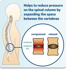 an image shows how aerial yoga helps reduce spinal column by expanding the space between vertabrae