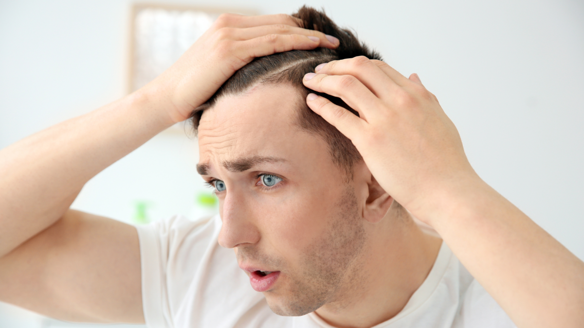 hair line receding, a white guy with blue eyes facing hair loss