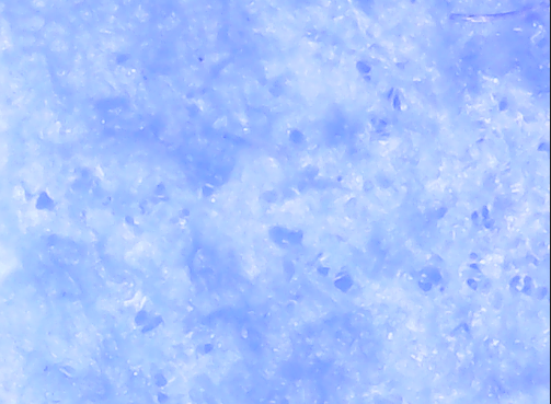 A close up of a blue surface

Description automatically generated