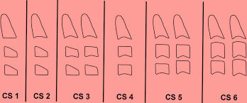 RÃ©sultat de recherche d'images pour "images maturitÃ© des vertÃ¨bres cervicales"