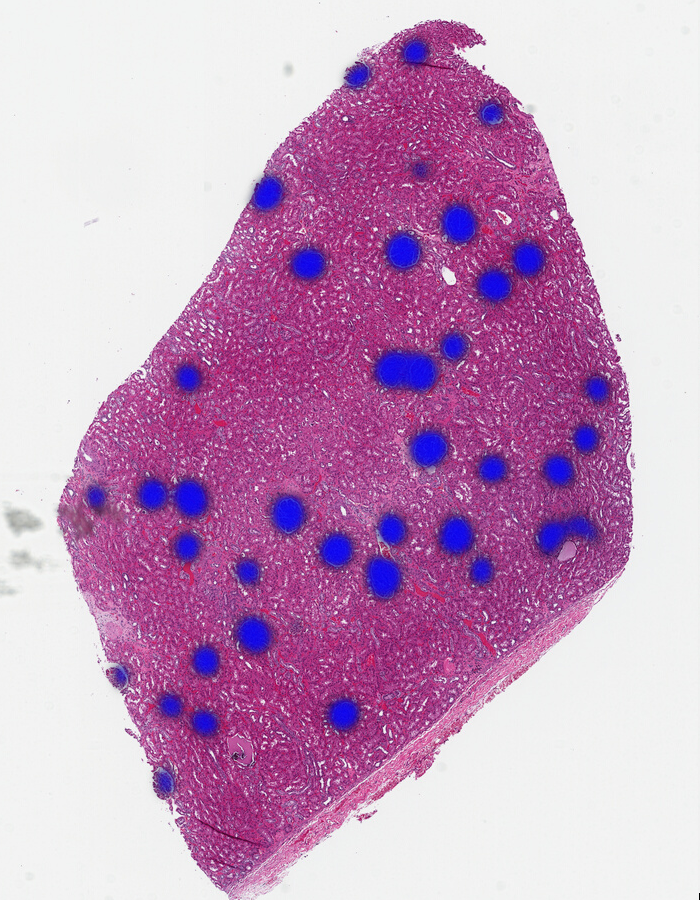 The sample renal tissue with most of the glomeruli located using the Midnight foundation model