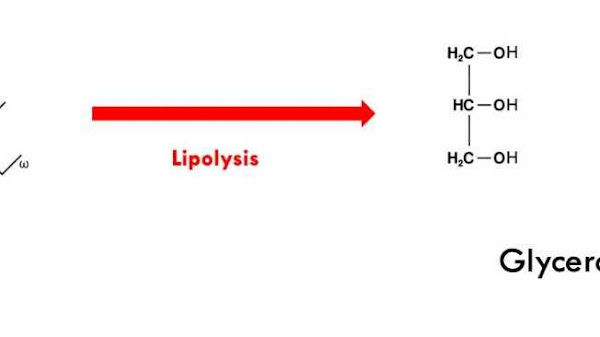 Viêm tụy cấp tăng triglyceride máu The Internet Book of Critical Care