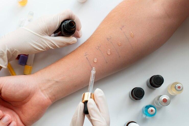 Immunotherapy for Allergy.jpg