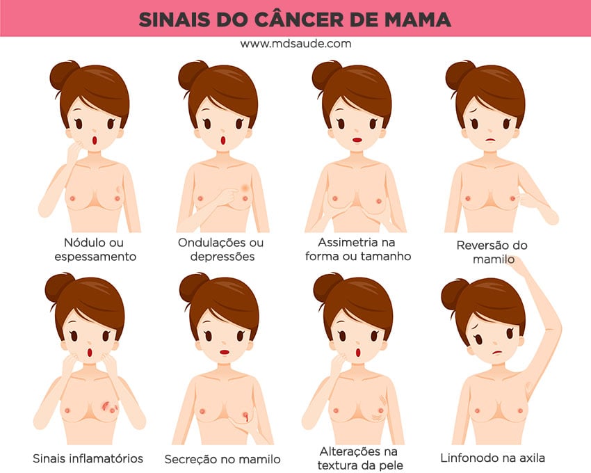 Principais sinais de tumor na mama