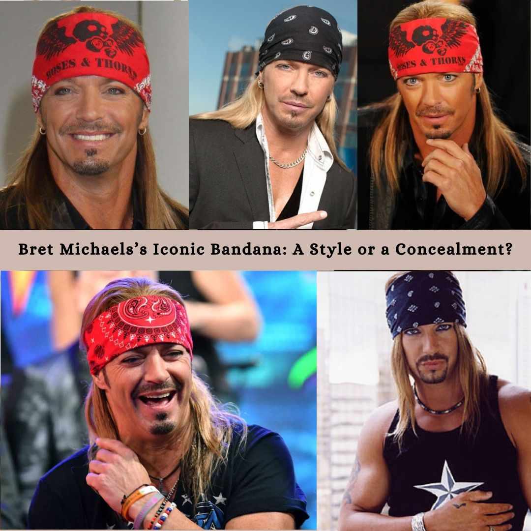 Bret Michaels’s Iconic Bandana: A Style or a Concealment?
