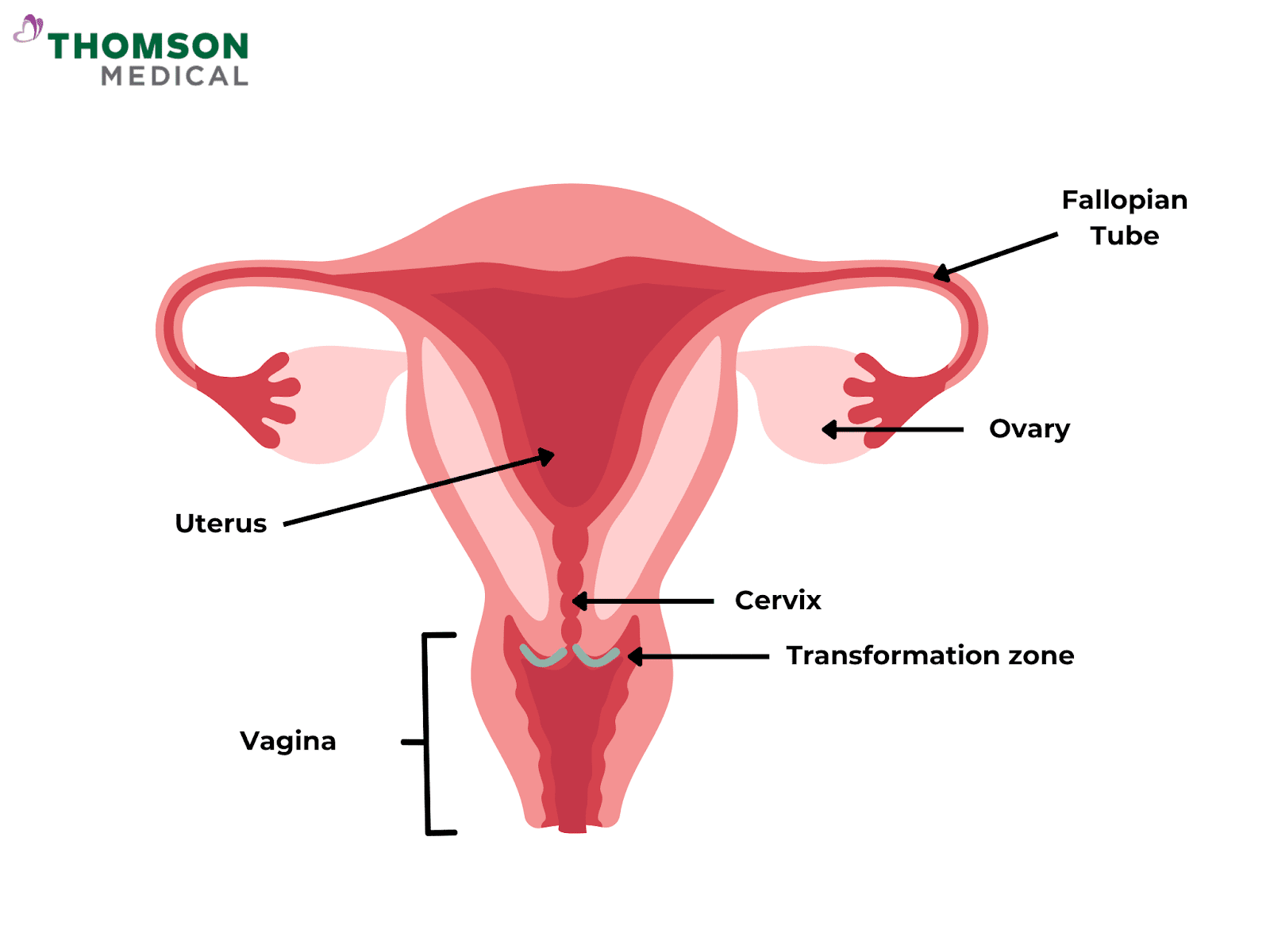 Transformation zone of cervix