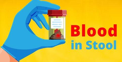 blood in stool