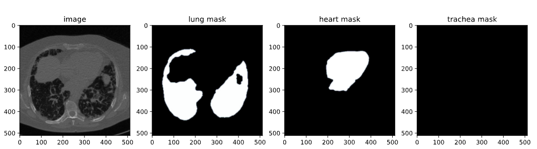 Fine-Tuning SAM 2 on a Custom Dataset: Tutorial | DataCamp