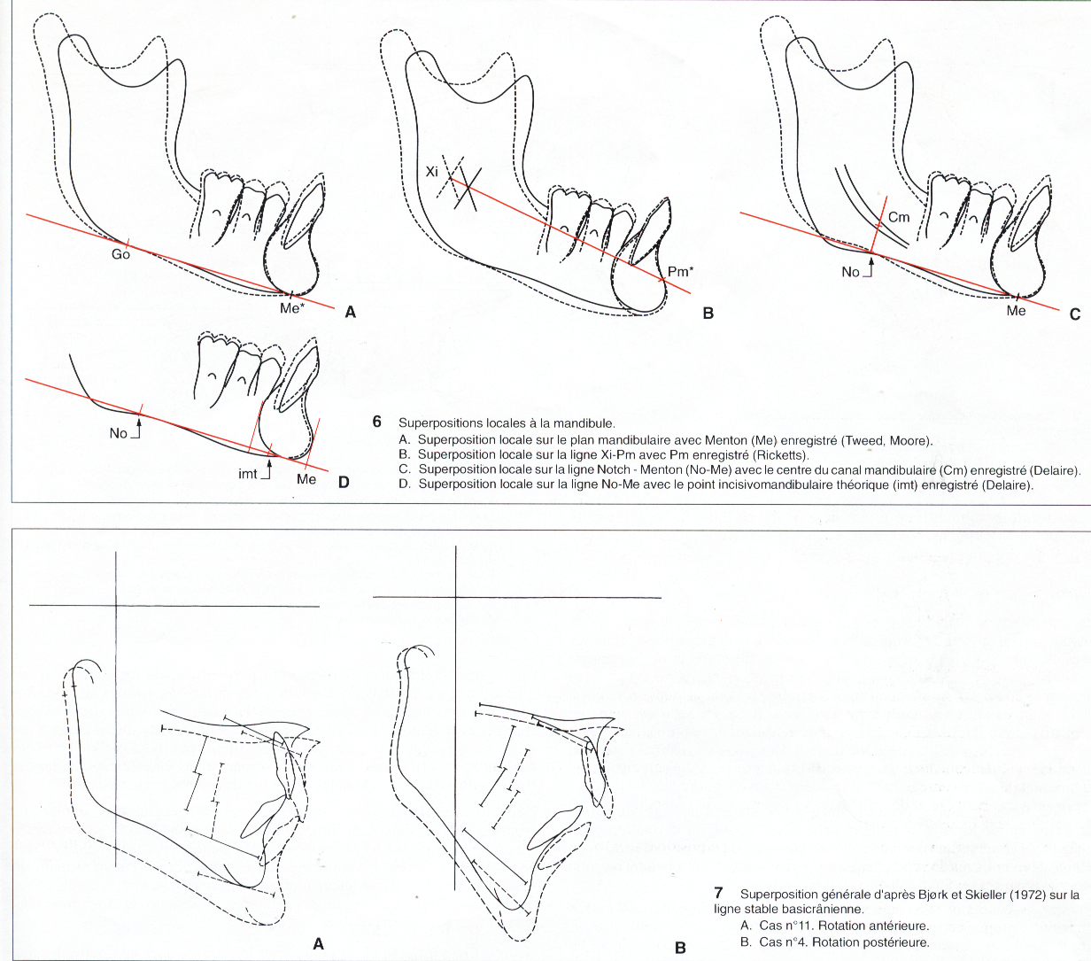 LES SUPERPOSITIONS