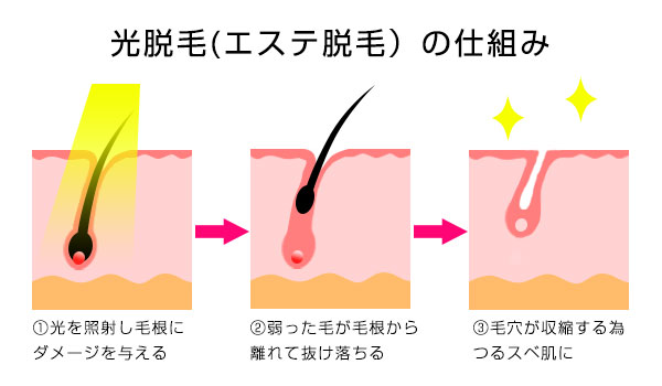 AV女優募集 求人