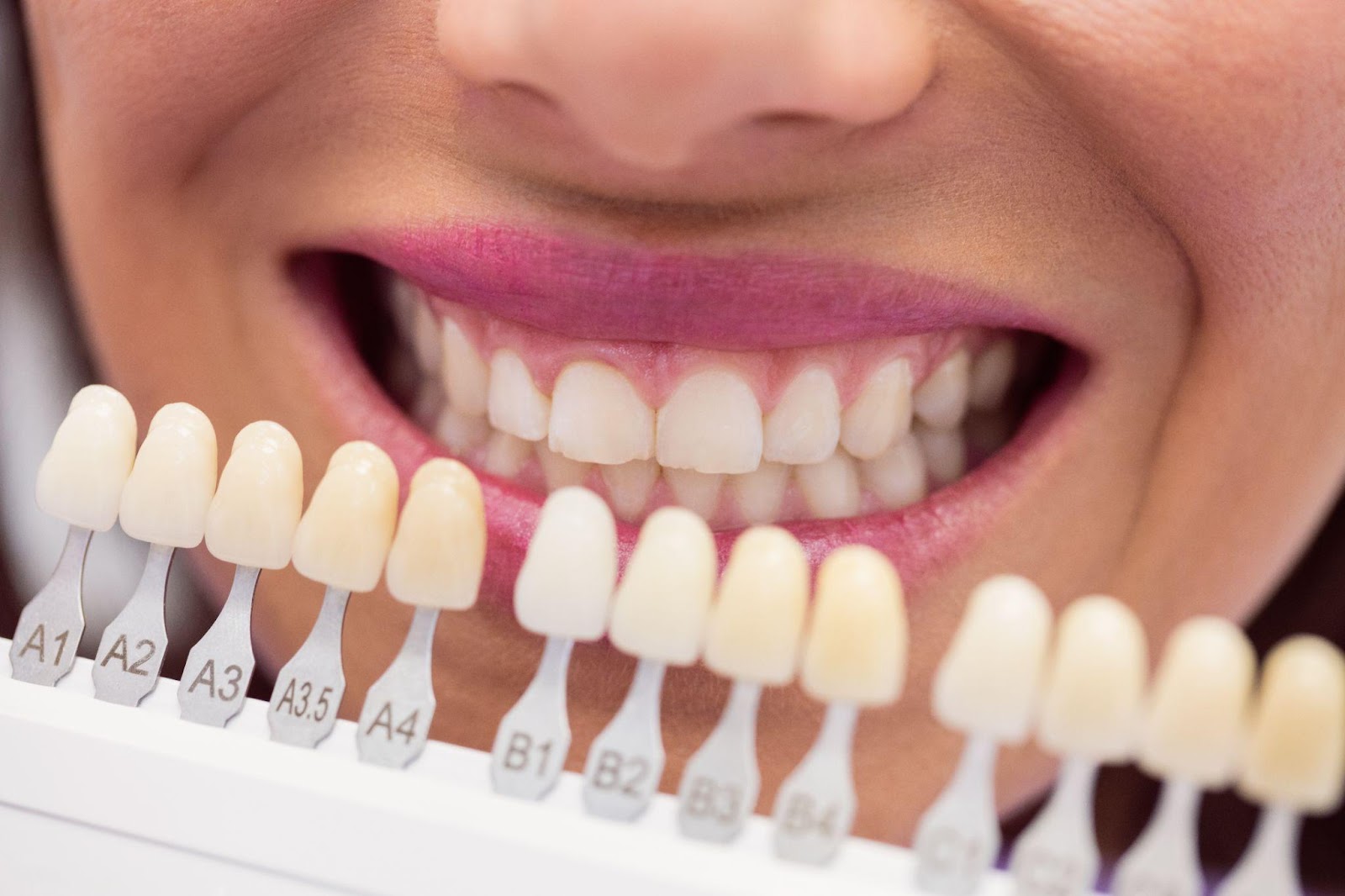 cerec crowns