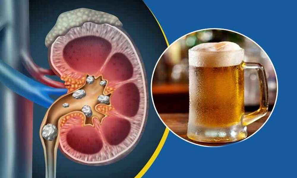 kidney-and-alcohol.jpg